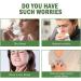 Stadsweg Respinature Herbal Lung Cleanse Mist 30ml Powerful Respiratory Support Spray - Buy Online on GoSupps.com
