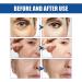Boto-X Serum Boto-X Stock Liquid Solution Boto-X Face Serum Anti Aging Serum for Face Face Tightening Serum Hyaluronic Acid Serum Brightening & Firming Serum Skincare for Reduce Fine Lines - Buy Online on GoSupps.com