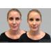 Dermaflage Waterproof Concealer Cream - Full Coverage Makeup (Golden Fair 6g) - Buy Online on GoSupps.com