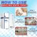 Calculus Free Dental Spray | Portable Teeth Cleaner & Oral Irrigator - 1pc - Buy Online on GoSupps.com
