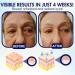 Exqst DobShow Advanced Eye Cream - Fast Wrinkle Repair for Dark Circles Tear Bags & Eye Folds | Shop Internationally - Buy Online on GoSupps.com