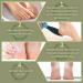 Double Sided Foot File Pedicure Foot Care Repair Tool Reusable Foot Scraper Hard Skin Remover Calluses Dead Skin Remover for Feet Foot Rasp File Foot Scrubber for Peel Wet Dry Cracked Feet Heel (Blue) - Buy Online on GoSupps.com