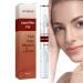 Skin Tag Removal, Skin Tag Remover, Mole Remover Pen, Skin Tag Remover Pen, Natural Non-Irritating Skin Tag Remover for All Skin Types