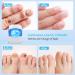 Incley Nail Fungus Cleaning Laser Device - Effective Blue Light Therapy for Toenails & Onychomycosis - Rechargeable Fungus Remover for Home Use - Buy Online on GoSupps.com