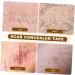 Patch Invisible Discr tion Cicatrice tanche Peau Respirante Mince Et L ger Adapt Corps Bras Jambes Voyage Camping - Buy Online on GoSupps.com