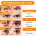 LANBENA Vitamin C Under Eye Patches - 60 Pcs Cooling Eye Masks for Dark Circles Puffiness Fine Lines & Anti-Aging - Hydrating Caffeine & Niacinamide Treatment - Buy Online on GoSupps.com