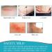 ZODENIS Silicone Scar Tape - Reusable Professional Scar Removal Sheets - 12 Month Supply - Buy Online on GoSupps.com