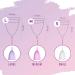 Buy Sirona Menstrual Cups - Large (Pack of 2) | Eco-Friendly Feminine Care | International Shipping - Buy Online on GoSupps.com