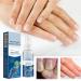 Furzero Nail Fungus & Athlete's Foot Treatment Spray - Medical Grade Anti-Itch Relief (3pcs) - Buy Online on GoSupps.com