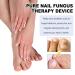 Szutfidy Infrared Nail Treatment Tool | Fungal Infection Prevention & Blue Light Therapy for Toenail & Fingernail Care - Home Use Nail Fungus Remover - Buy Online on GoSupps.com