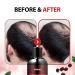 KUNDAL Baby Powder Anti-Hair Loss Shampoo 10.14 Fl Oz - Caffein Scalp Care for Deep Cleansing - Buy Online on GoSupps.com