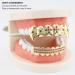 Gold Braces Set - Custom Fit Hip Hop & Punk Teeth Grillz | Metal Decoration Jewelry for Oral Care (Pink) - Buy Online on GoSupps.com