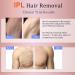 MiSMON IPL Hair Removal: Permanent Hair Removal for Women/ Men - At-Home Hair Removal Machine for Bikini, Legs, Underarm, Arm, Body - Safe & Effective - Buy Online on GoSupps.com