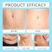 Skin Firming Cream Body Firming Cream for Loose Skin Skin Tightening Cream for Stomach Belly Firming Cream for Women&Men Skin Firming Lotion for Cellulite and Stretch Marks Lifting Moisturizing - Buy Online on GoSupps.com
