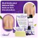 Tinea Versicolor Treatment Pack by Naturasil | Fast Relief for Skin Discoloration & Itching | 4oz Lotion 4oz Soap 15ml Oil | Treats Candida Jock Itch & Ringworm - Buy Online on GoSupps.com