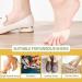 SooGree Ball of Foot Cushion Pads - Thicken Forefoot Metatarsal Cushion for Women Men - Pain Relief & Prevention - 5 Pairs Beige - Buy Online on GoSupps.com