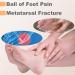 4 Pairs Gel Insert Pads for Ball of Foot | Metatarsal Pain Relief & Cushioning - Forefoot Support for Men & Women - Buy Online on GoSupps.com
