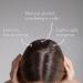 Good&All Dry Itchy Scalp Treatment | Leave-in Itch Relief with Peppermint & Bisabolol | Fragrance-Free Vegan Cruelty-Free - 5.58 fl oz - Buy Online on GoSupps.com