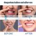 Spray Contre les Maux de Dents Soulagement Instantan des Maux de Dents Spray de Soulagement de la Douleur Dentaire R paration des Gencives 20ML 1PC - Buy Online on GoSupps.com
