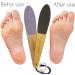 Pedicure Foot File Kit - Double Sided Callus Remover & Heel Rasp for Smoother Feet - 2pcs Set - Buy Online on GoSupps.com