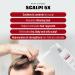 Enfanti Scalpi 5X Scalp Cleanser - Pore Cleanser & Deep Cleanse Spray for Thinning Hair & Dry Skin | Biotin Infused | 4.2 fl oz - Buy Online on GoSupps.com