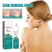 Advanced Scar Spray for Acne, Surgical Scars & Stretch Marks - Gentle Skin Care Treatment for Dark Spots - All Types of Scars Remover - Buy Online on GoSupps.com