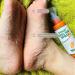 Xebular Immediate Foot Peeling Spray - Quick Dead Skin Removal & Foot Mask for Smooth Feet - Buy Online on GoSupps.com