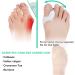DYKOOK Bunion Corrector & Toe Straightener with Gel Cushions - Big Toe Separators and Splint for Bunion Relief - Buy Online on GoSupps.com
