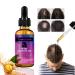 Trendyfave Hair Growth Serum Vitamins Serum for Hair Loss and Hair Regrowth Ginger Oil for Hair Growth for Balding Thinning Repairs Hair Follicles Natural Herbal Hair Growth Oils for Men and Women