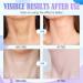 Neck Firming Cream - Tightening & Lifting for Sagging Skin | Moisturizing Skin Care - 1.7 oz - Buy Online on GoSupps.com