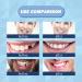 30 ml Dental Repair Set for Dentures - Heat Fit Pearls for Temporary Tooth Restoration - Easy Instructions Included - Buy Online on GoSupps.com