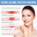 Acne Pimple Patches - Absorbing Cover with Tea Tree Oil Invisible Blemish Spot Hydrocolloid Skin Treatment Facial Stickers Five Sizes Blends in with skin - Buy Online on GoSupps.com