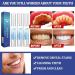 Gum Therapy Gel: 3pcs Teeth Whitening Pens for Gum Treatment - Buy Online on GoSupps.com
