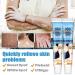 Vitiligo Therapy Cream: Soothing Ointment to Reduce White Spots & Improve Skin Pigmentation - Buy Online on GoSupps.com