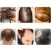 OGNIWO Organic Pumpkin Oil for Hair Growth Pumpkin Seed Oil Pure Organic Cold Pressed Natural Moisturizer Hair Growth Promoting Oil Anti Hair Loss Hair Oil Hair Oil 60ml - Buy Online on GoSupps.com