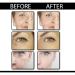 3 PCs Biophotonix Youth Retinol Serum for Face | Anti-Aging Moisturizer Reduces Fine Lines & Hydrates Skin - Buy Online on GoSupps.com