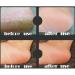 Silicone Gel Heel Sleeve - 4 Pairs Breathable Cushion for Plantar Fasciitis - Instant Pain Relief! - Buy Online on GoSupps.com