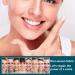 Soft Denture Reline Kit False Teeth Set Snap on Veneers Teeth Clip on Veneers Top and Bottom Denture Silicone Reline Kit Dentures for Missing Teeth Clip in Teeth Veneers Replacement Teeth for Adults - Buy Online on GoSupps.com