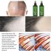 S rum De Croissance Des Cheveux Lotion Capillaire Hommes Et Femmes De Tous Types De Cheveux Aide La Croissance Des Cheveux Spray Au Gingembre Nourrissant. (2 pcs) - Buy Online on GoSupps.com