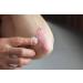 Psoriasis Treatment Gel - Advanced Relief for Flaking & Irritation - Hydrating Soothing Non-Greasy Formula - Fast-Absorbing 2 oz | International Shipping Available - Buy Online on GoSupps.com
