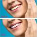 Perfect Smile Dentures Pebbles - Cosmetic Veneers & Temporary Prostheses for Men & Women | 6 Pairs of Reusable Tooth Whitener - Buy Online on GoSupps.com
