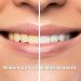 Glow On The Go Professional Teeth Whitening Pen | Enamel Safe Rechargeable Blue-Light Technology | No Sensitivity | Travel Friendly | Mint - Buy Online on GoSupps.com