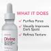 Niacinamide Serum 12% + Zinc 2% - Reduce Dark Spots & Minimize Pores | Dewy Youthful Glow - 1 fl oz - International Shipping - Buy Online on GoSupps.com