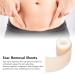 Self-Adhesive Reusable Scar Tape Roll for Postpartum Recovery | Scar Gel Tape - Buy Online on GoSupps.com