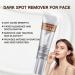 IZBEAUVO Dark Spot Remover for Face Dark Spot Cream Freckle Removal Cream Dark Spot Correcting Glow Serum Dark Spot Corrector Cream Dark Spot Remover Sunspots & Melasma Cream Anti-Aging - Buy Online on GoSupps.com