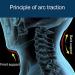Pepdro Neck Support - Cervical Traction Device for Spine Alignment at Home | 360 Airbag Compression - Giallo - Buy Online on GoSupps.com