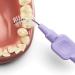 Tepe Interdental Brushes Extra Soft Purple (ISO Size 6) - Gentle & Effective Cleaning for Interdental Spaces - 2 Packs of 8 Brushes - Buy Online on GoSupps.com