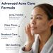Pharmlitalia Azelaic Acid 15 Acne Cream for Face - Redness Relief Rosacea Treatment for Face - Soothes Acne Hyperpigmentation Enhanced Formula for Brighter Healthier Skin Care - Buy Online on GoSupps.com
