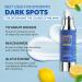 Buy Dark Spot Cream - Effective Dark Spot Remover for Face & Body | 50ml Dark Spot Corrector for Neck Hands Legs & Intimate Areas - Buy Online on GoSupps.com