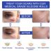 Professional Grade Silicone Scar Removal Sheets - 1.6 x 120 3M - For C-Section Surgery, Burn, Acne, Stretch Marks - Works on Old & New Scars - Reusable - Buy Online on GoSupps.com